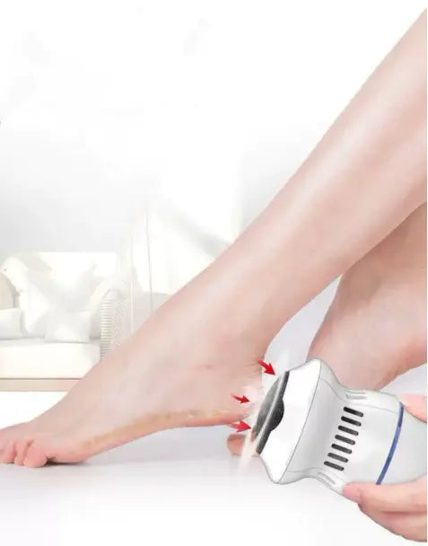 Removedor de calos e rachaduras Beauty Feet Tangorila